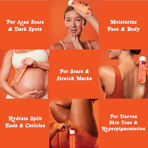 Bio-Oil Skincare Body Oil Serum for Scars and Stretch Marks, Face and Body Moisturizer with Vitamin E & A for Sensitive Dry Skin, Dermatologist Recommended, Travel Size, .85 oz, Pack of 3